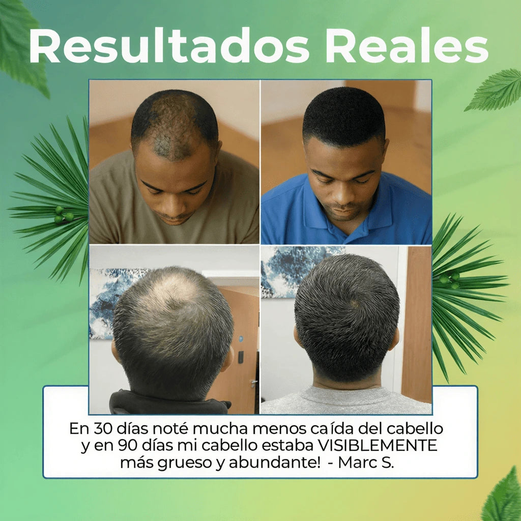 DHT BLOCKER Suplemento para el crecimiento de cabello